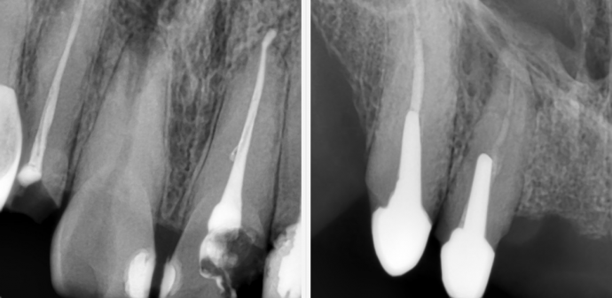 Рентген в стоматологии Рентген в стоматологии