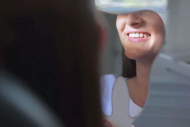 Виниры на зубы